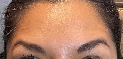 Silikónové náplasti proti vráskam – oči & čelo (balíček)