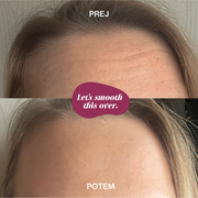 Silikónová náplasť na vrásky na čele